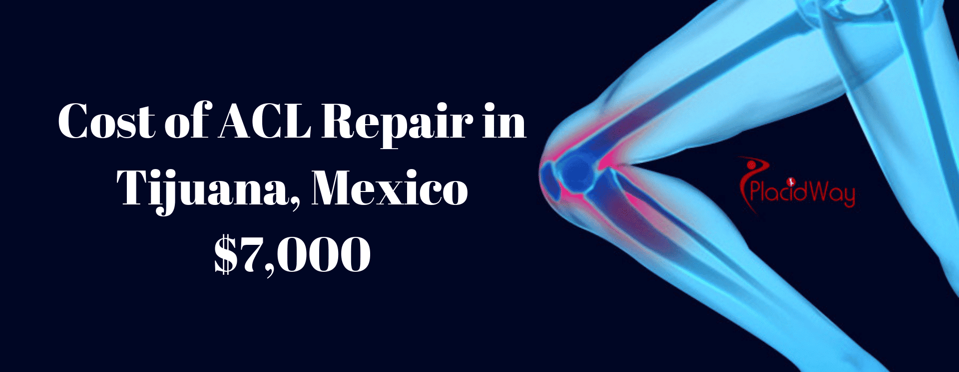 Cost of ACL Repair  in Tijuana, Mexico 